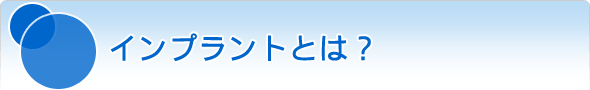 インプラントとは？