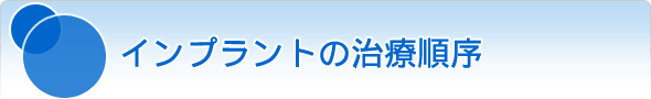 インプラントの治療順序